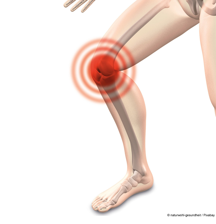 Arthrose – immer gleich ein neues Gelenk?