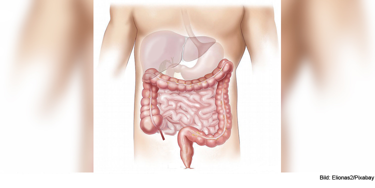 Darmkrebsmonat März: Online-Vorträge zu Prävention, Diagnostik, Therapie