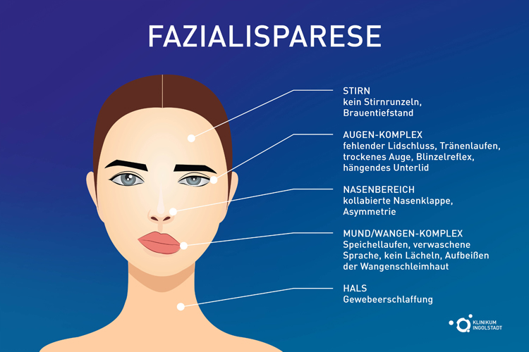 Lähmungen des Gesichtsnervs beeinträchtigen mehr als nur die Mimik