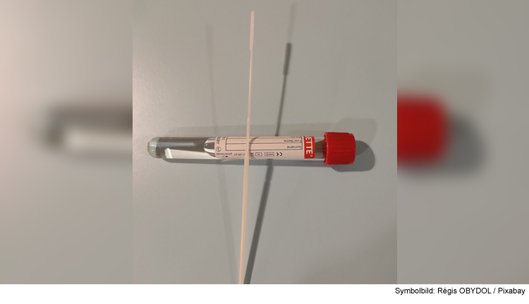 PCR-Tests nur noch 24 Stunden gültig